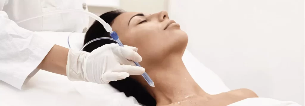 Naujiena Lietuvoje - neinvazinis odos gydymas su JETPEEL technologija! 1 JETPEEL – veido ovalą dailinanti procedūra